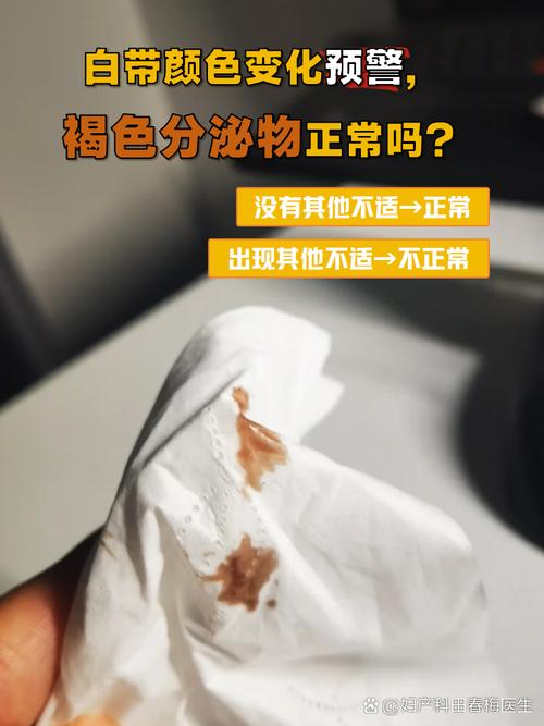 怀孕期间白带是咖啡色-第3张图片-郑州医学网