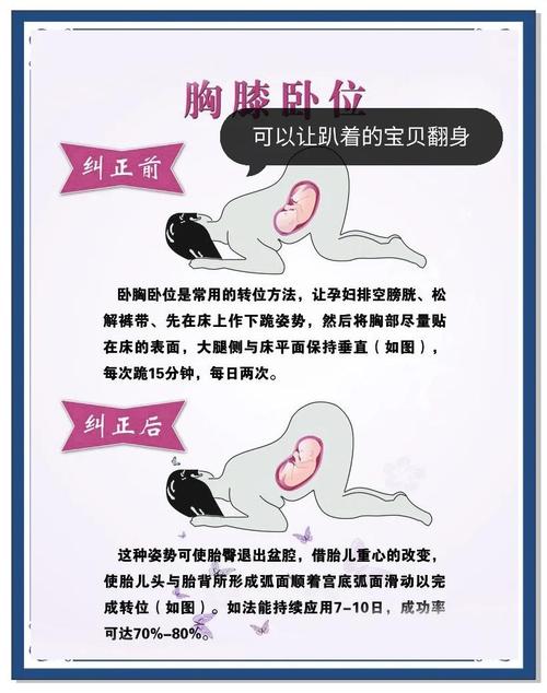 孕期四维彩超是必须检查吗?不做会有哪些风险?-第2张图片-郑州医学网 孕期四维彩超是必须检查吗?不做会有哪些风险?-第2张图片-郑州医学网