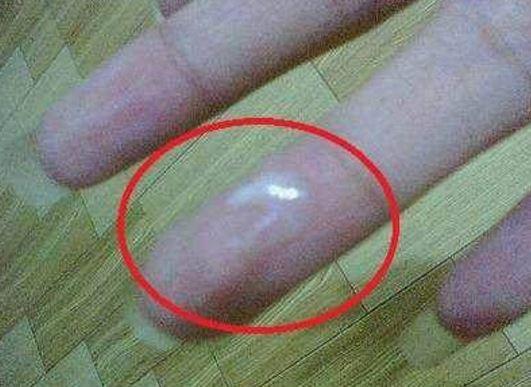 怀孕期间出现分泌物正常吗?需要警惕哪些异常情况?-第2张图片-郑州医学网 怀孕期间出现分泌物正常吗?需要警惕哪些异常情况?-第2张图片-郑州医学网