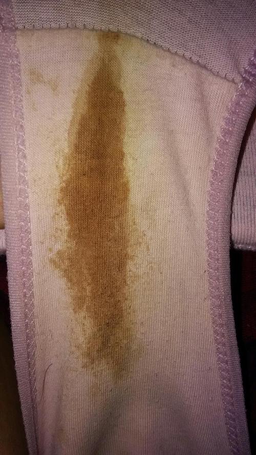 怀孕期间出现棕色分泌物，是正常现象还是身体异常信号？-第1张图片-郑州医学网