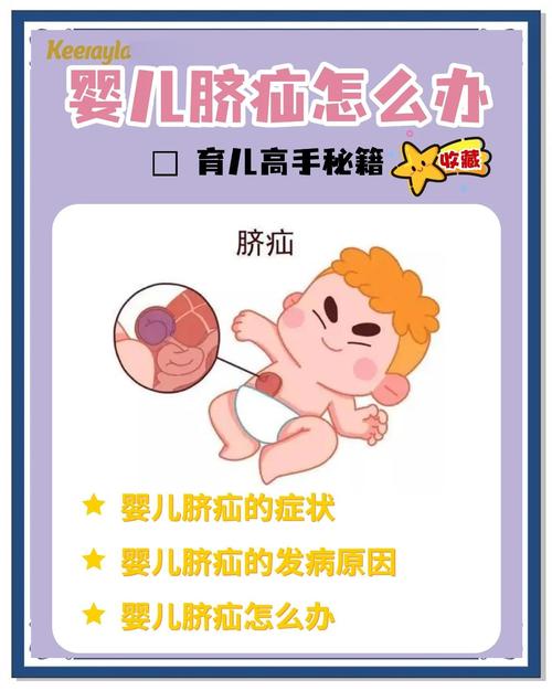 儿童肚脐眼异常该挂什么科？儿科还是外科？家长该如何正确判断？-第2张图片-郑州医学网
