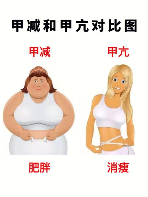 甲减和孕期甲减的区别-第1张图片-郑州医学网 甲减和孕期甲减的区别-第1张图片-郑州医学网