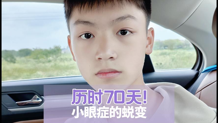 新生儿眼睛大会变小吗?婴幼儿眼部发育规律与变化趋势解析-第2张图片-郑州医学网 新生儿眼睛大会变小吗?婴幼儿眼部发育规律与变化趋势解析-第2张图片-郑州医学网