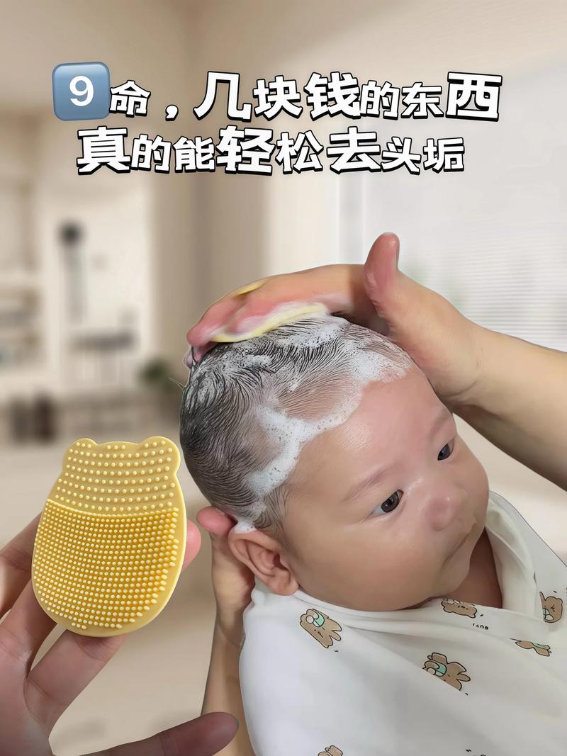 新生儿头发特别容易油是正常现象吗？需要如何科学护理？-第2张图片-郑州医学网