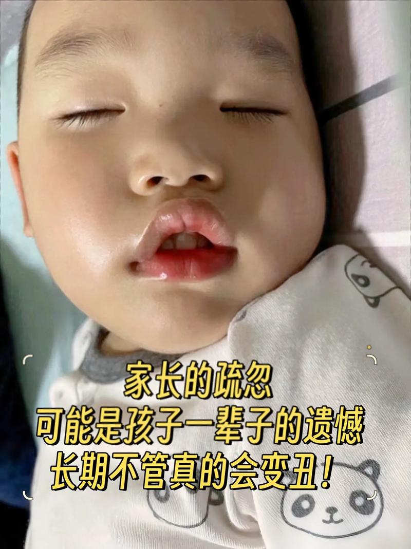 新生儿醒着总张嘴是正常现象还是健康预警?需关注哪些潜在问题?-第1张图片-郑州医学网 新生儿醒着总张嘴是正常现象还是健康预警?需关注哪些潜在问题?-第1张图片-郑州医学网