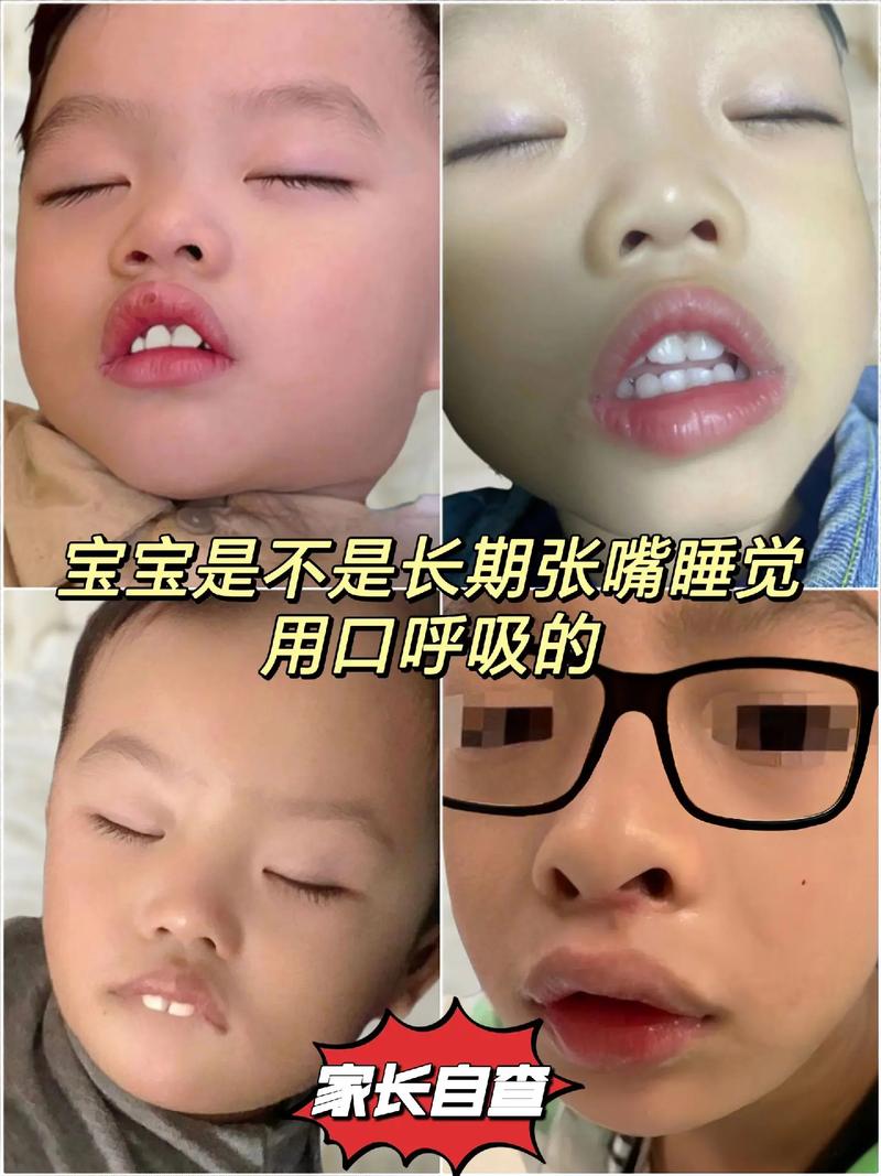 新生儿醒着总张嘴是正常现象还是健康预警?需关注哪些潜在问题?-第3张图片-郑州医学网 新生儿醒着总张嘴是正常现象还是健康预警?需关注哪些潜在问题?-第3张图片-郑州医学网