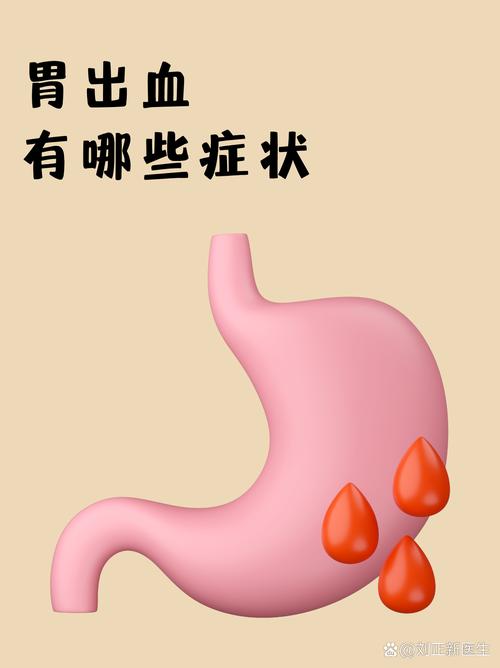 孕期胃黏膜出血了怎么办？会对胎儿有影响吗？该怎么治疗和护理？-第3张图片-郑州医学网