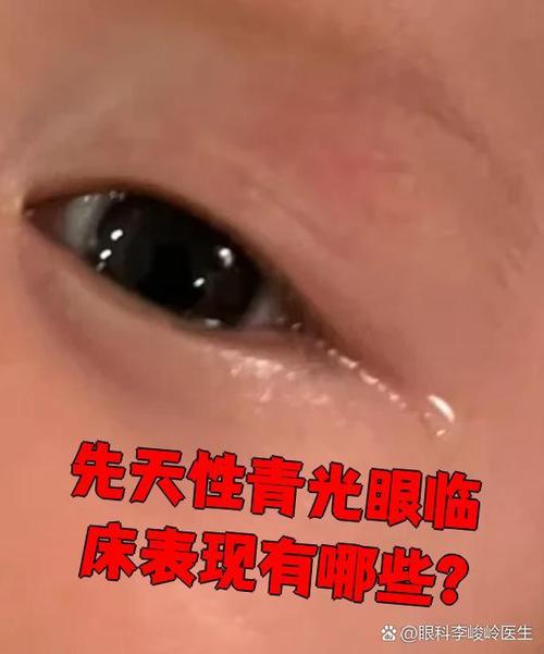 新生儿眼睛被强光刺激后，会留下永久性损伤吗？-第1张图片-郑州医学网