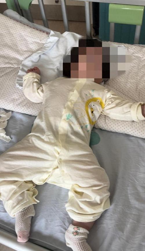 新生儿黄疸轻度脑损伤会影响宝宝发育吗？如何及时发现与干预？-第1张图片-郑州医学网