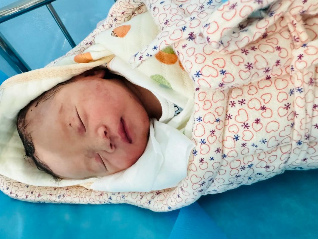 新生儿黄疸轻度脑损伤会影响宝宝发育吗？如何及时发现与干预？-第3张图片-郑州医学网