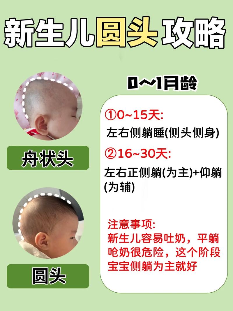 新生儿头顶尖一定要睡头型吗？科学调整姿势与时机指南-第3张图片-郑州医学网