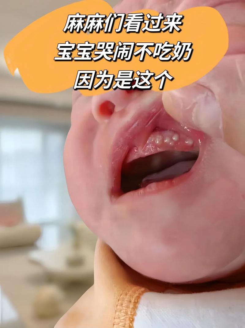 新生儿喝奶粉后半夜哭闹，是奶粉不合适还是喂养方式有问题？-第3张图片-郑州医学网