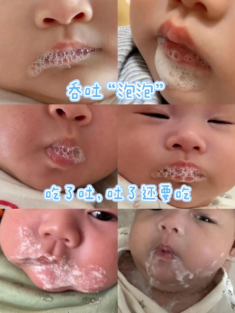 新生儿吃完母乳吐泡泡是正常现象还是异常信号？-第2张图片-郑州医学网