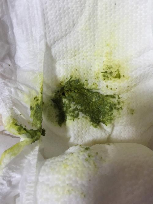 新生儿拉绿色酸味粑粑是消化不良还是其他问题？-第1张图片-郑州医学网