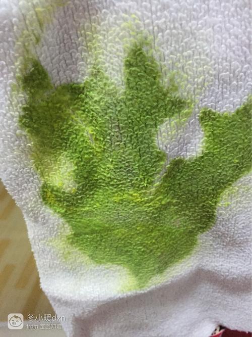 新生儿拉绿色酸味粑粑是消化不良还是其他问题？-第2张图片-郑州医学网