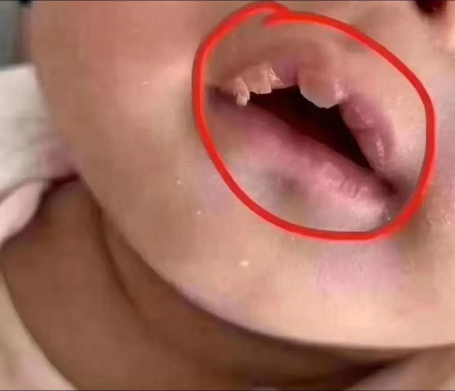 新生儿吃完奶嘴唇发白是正常现象还是缺氧信号？需警惕哪些潜在问题？-第2张图片-郑州医学网