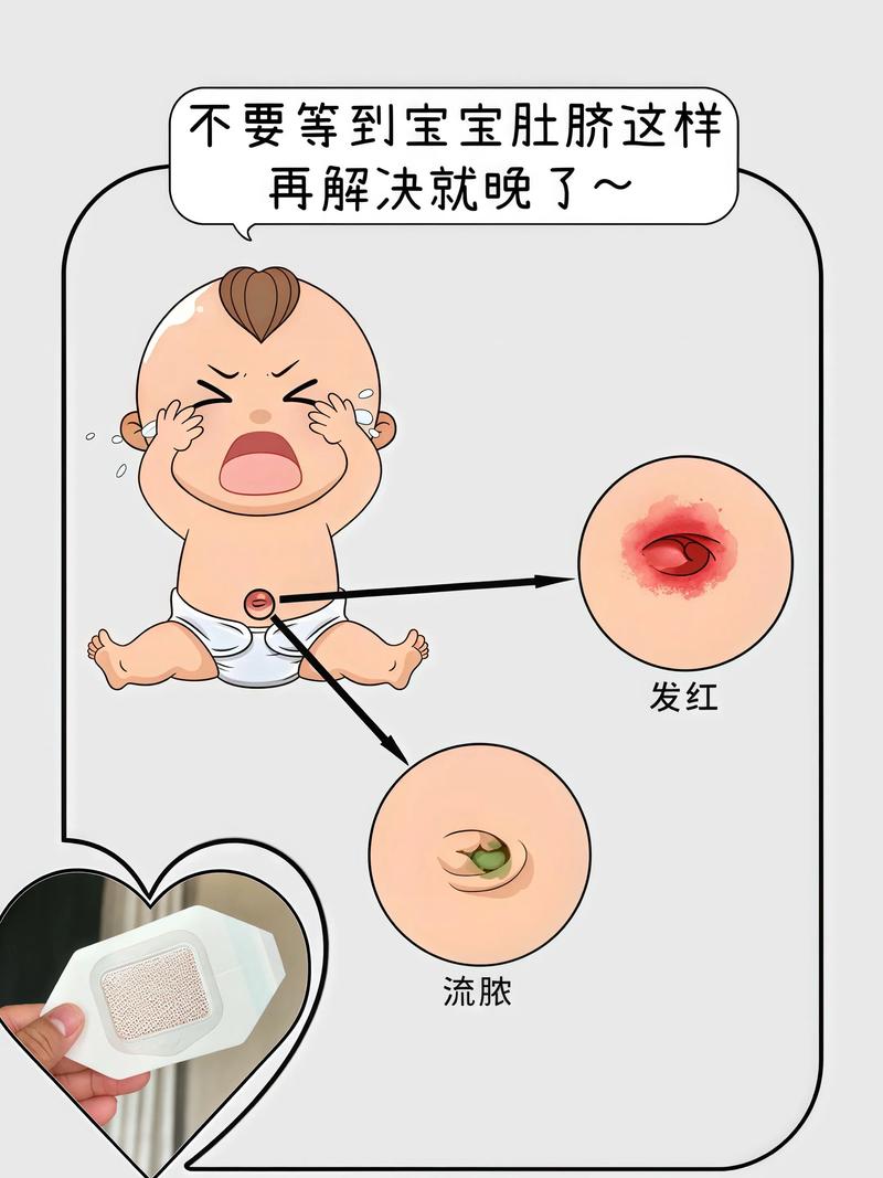 新生儿肚脐清洗后有点血是正常现象吗?需要特别处理吗?-第2张图片-郑州医学网 新生儿肚脐清洗后有点血是正常现象吗?需要特别处理吗?-第2张图片-郑州医学网