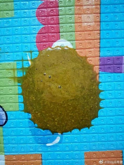 新生儿母乳喂养出现蛋花状大便，是消化异常还是正常现象？-第2张图片-郑州医学网