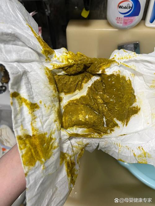 新生儿没喝完的奶粉，能留下次喝吗？这样处理真的安全吗？-第1张图片-郑州医学网