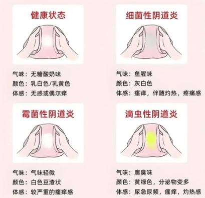 孕期白带发黄外阴瘙痒-第1张图片-郑州医学网 孕期白带发黄外阴瘙痒-第1张图片-郑州医学网