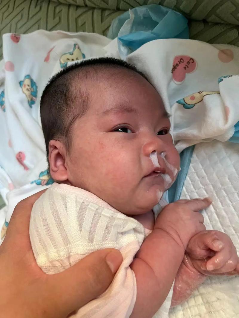 新生儿接种疫苗后呕吐，是正常反应还是需要警惕的健康信号？-第2张图片-郑州医学网