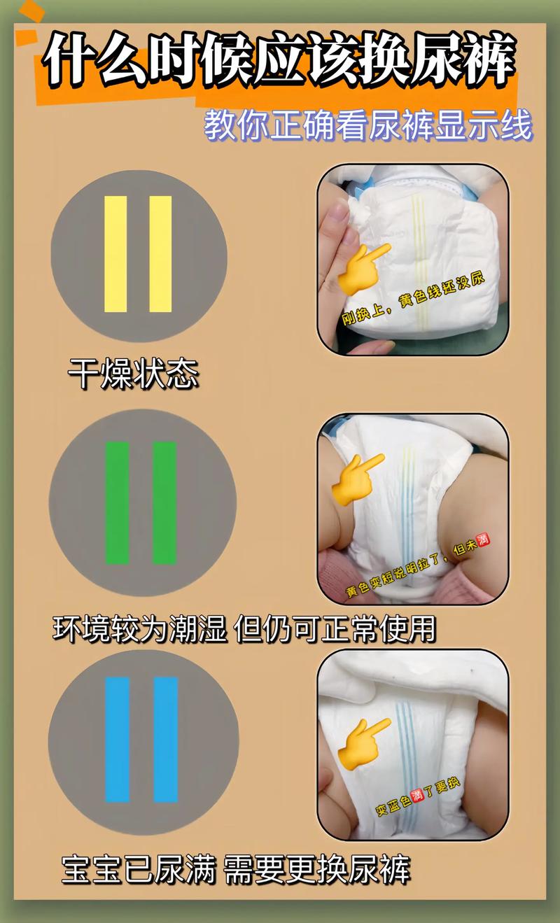 新生儿尿不湿总漏尿？是尺码选错还是穿戴方式有问题？-第3张图片-郑州医学网