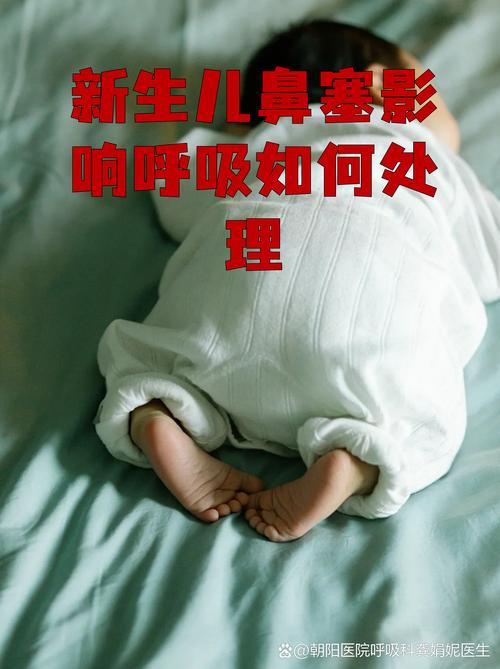 新生儿鼻塞发出猪叫声是感冒了还是正常现象？如何护理？-第2张图片-郑州医学网