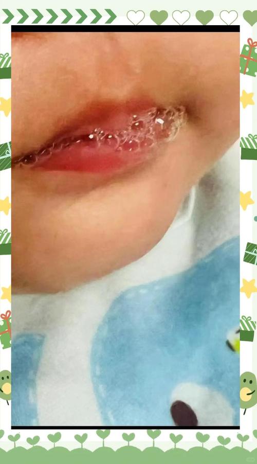 新生儿嘴巴吐粘稠泡泡是正常现象还是疾病信号？需警惕哪些潜在问题？-第1张图片-郑州医学网