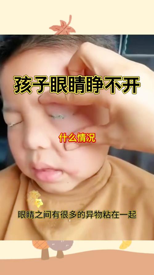 新生儿晚上不睡觉睁眼-第1张图片-郑州医学网