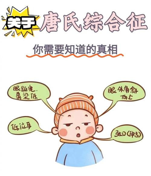 孕期唐氏综合症有哪些具体表现？如何通过症状早期识别与筛查？-第1张图片-郑州医学网