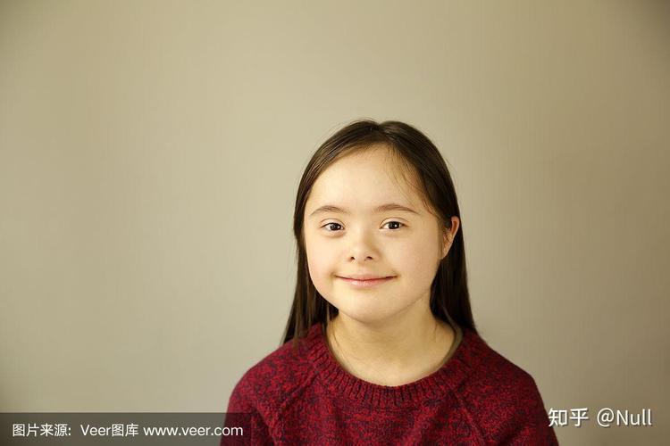 孕期唐氏综合症有哪些具体表现？如何通过症状早期识别与筛查？-第3张图片-郑州医学网