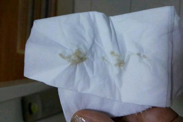 孕期分泌物发黄是正常现象吗?会对胎儿有影响吗?需要怎么处理?-第1张图片-郑州医学网 孕期分泌物发黄是正常现象吗?会对胎儿有影响吗?需要怎么处理?-第1张图片-郑州医学网