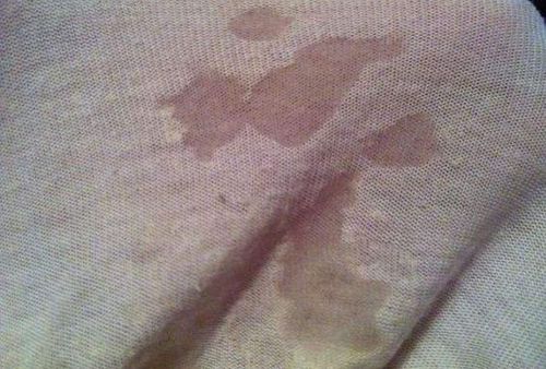 孕期分泌物发黄是正常现象吗?会对胎儿有影响吗?需要怎么处理?-第2张图片-郑州医学网 孕期分泌物发黄是正常现象吗?会对胎儿有影响吗?需要怎么处理?-第2张图片-郑州医学网