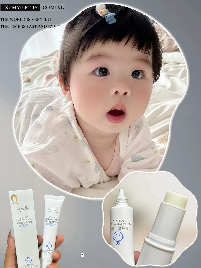 儿童嘴巴周围发红是上火了吗？该如何正确处理和预防？-第2张图片-郑州医学网