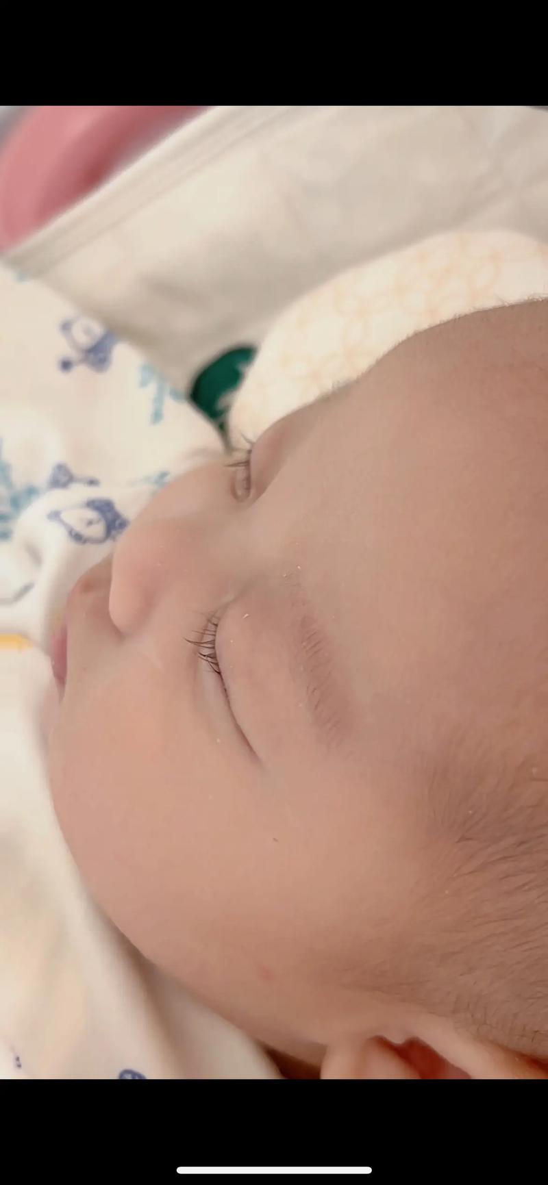 新生儿为什么没有睫毛？是发育未完全还是另有进化奥秘？-第2张图片-郑州医学网