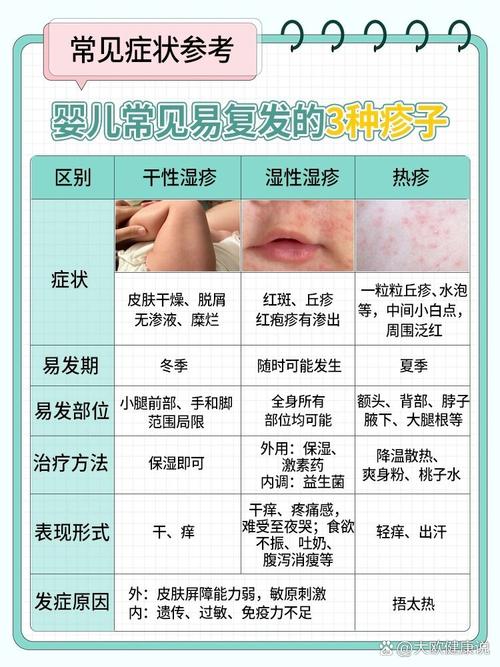 新生儿干性湿疹的诱因究竟有哪些？日常护理中哪些细节可能加重症状？-第2张图片-郑州医学网