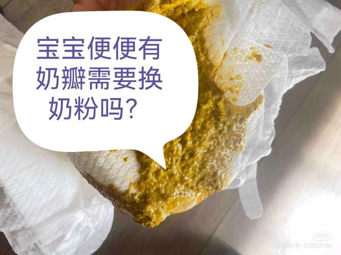 新生儿喝奶粉后大便形状异常怎么办？需要调整奶粉配方吗？-第2张图片-郑州医学网