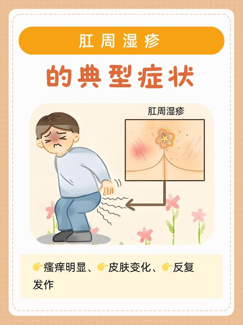 孕期肛门瘙痒是激素变化还是疾病信号？如何缓解才安全？-第1张图片-郑州医学网