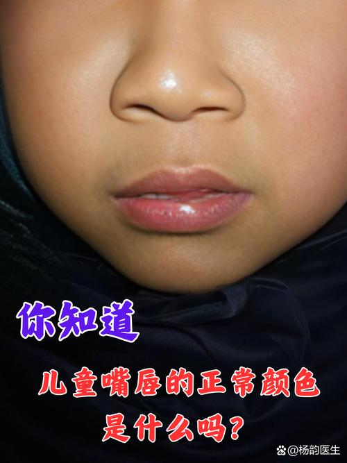 新生儿宝宝上嘴唇突出是正常发育还是异常信号？需警惕哪些潜在问题？-第1张图片-郑州医学网