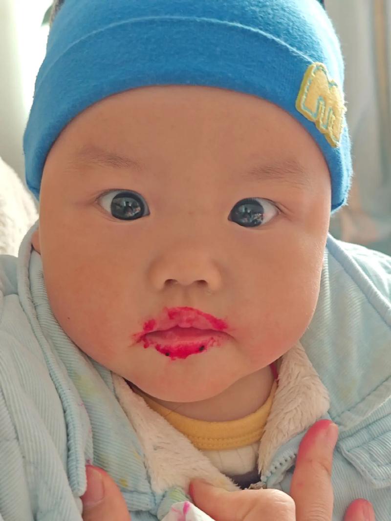 新生儿宝宝上嘴唇突出是正常发育还是异常信号？需警惕哪些潜在问题？-第2张图片-郑州医学网