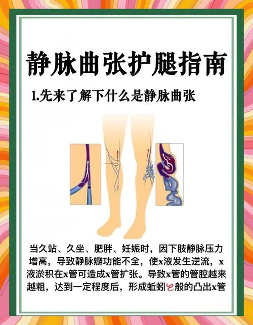 孕期静脉曲张高发，怎么缓解才能既安全又有效？-第2张图片-郑州医学网