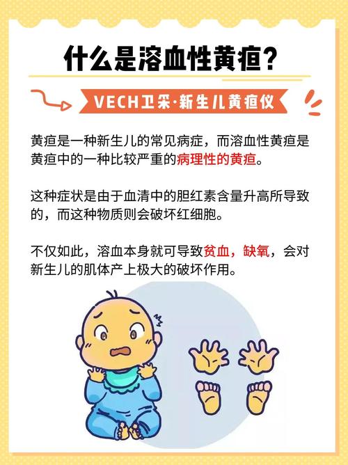 新生儿黄疸与妈妈血型到底有什么必然联系？-第1张图片-郑州医学网