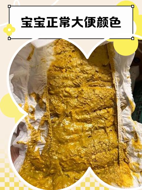 新生儿吃奶粉后一直没大便，是奶粉不合适还是正常现象？-第1张图片-郑州医学网