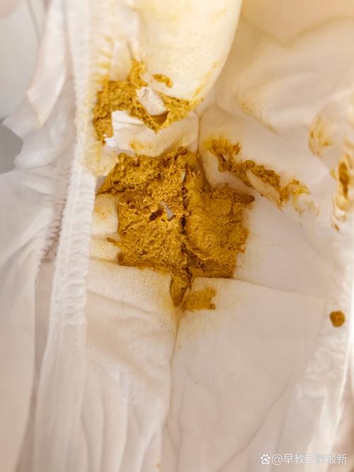 新生儿吃奶粉后一直没大便，是奶粉不合适还是正常现象？-第2张图片-郑州医学网