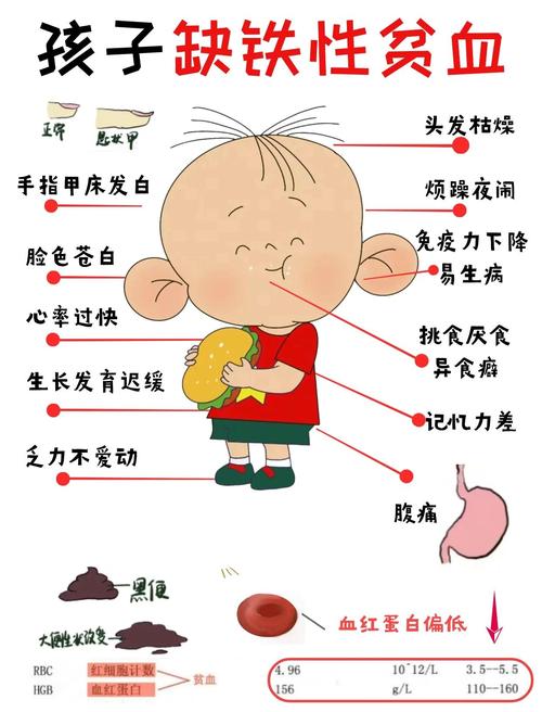 儿童地中海贫血怎么办？有哪些有效治疗方法和日常护理建议？-第2张图片-郑州医学网