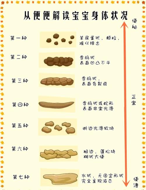 新生儿出生后小便和大便的频率及正常时间范围是怎样的？-第1张图片-郑州医学网