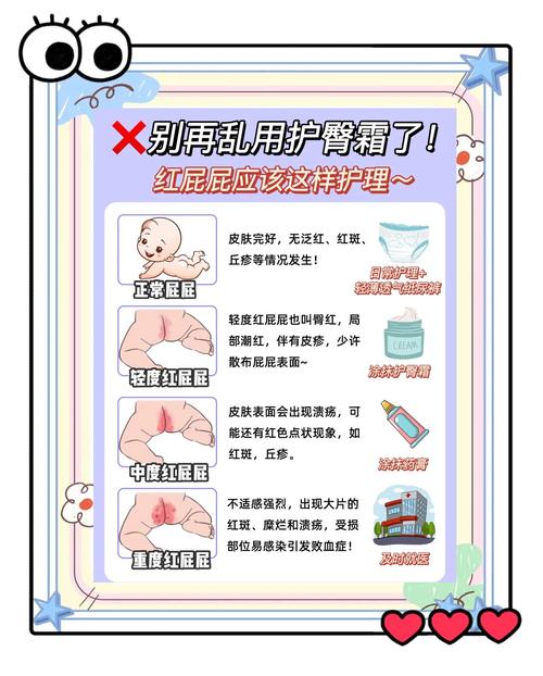 新生儿红屁屁反复发作，到底该如何科学护理才能有效预防？-第1张图片-郑州医学网
