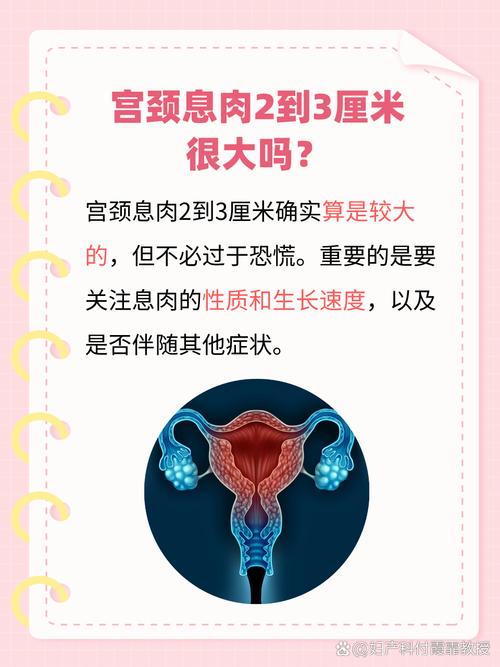 宫颈息肉会影响孕期健康吗？它会导致出血或早产风险吗？-第3张图片-郑州医学网