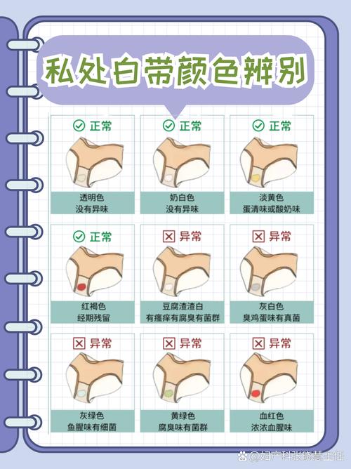 孕期水样白带是正常现象吗？需要警惕哪些异常情况？-第2张图片-郑州医学网