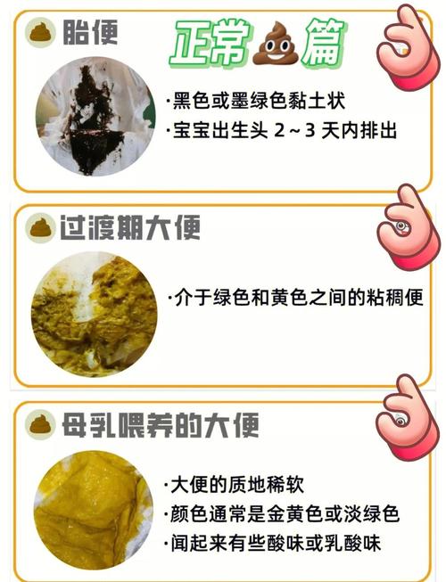 新生儿睡觉发出拉屎声是正常现象还是健康预警？-第1张图片-郑州医学网